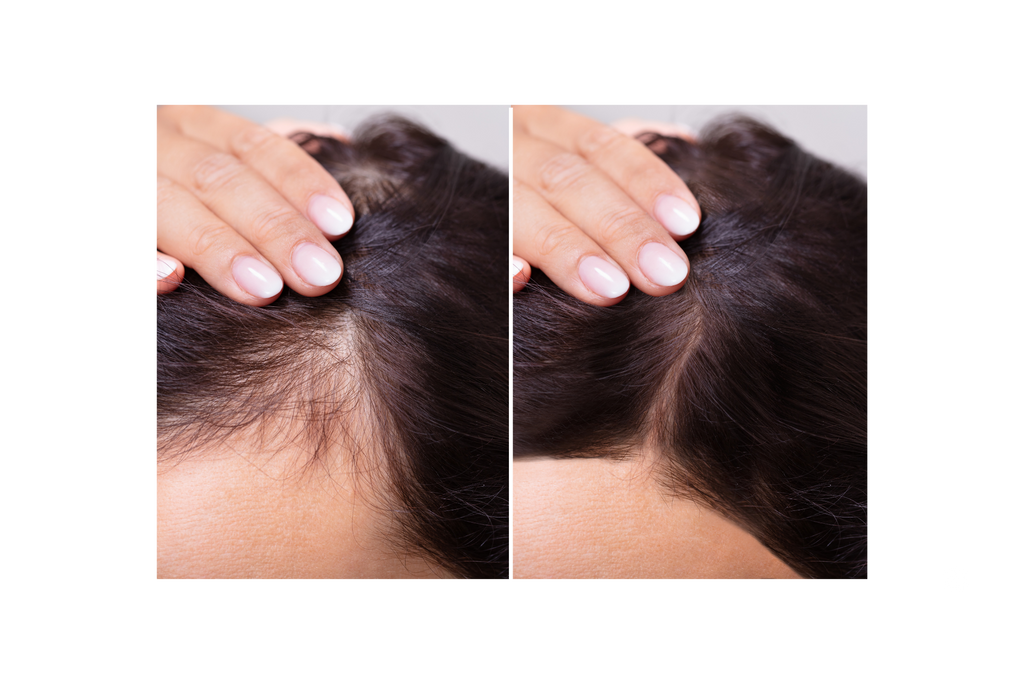 avant après cheveux résultat luminothérapie led rouge brosse capillaire 