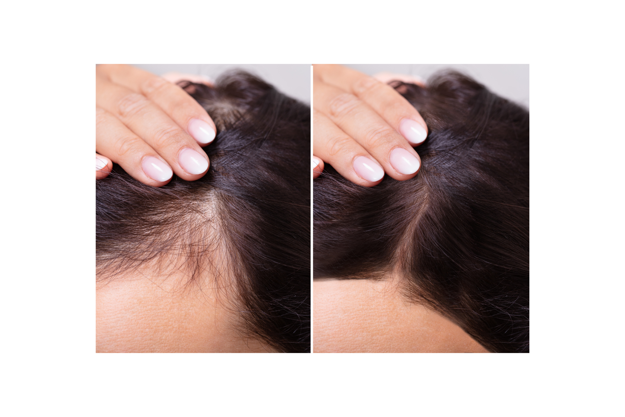 avant après cheveux résultat luminothérapie led rouge brosse capillaire 