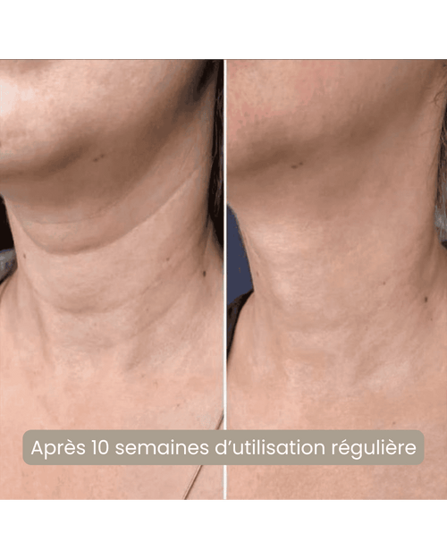 Pack masque LED visage + cou | soin anti-âge