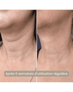 Avant après masque LED cou Nova Rituals - résultat peau fermeté décolleté