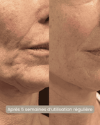 Masque LED visage Soin anti-âge