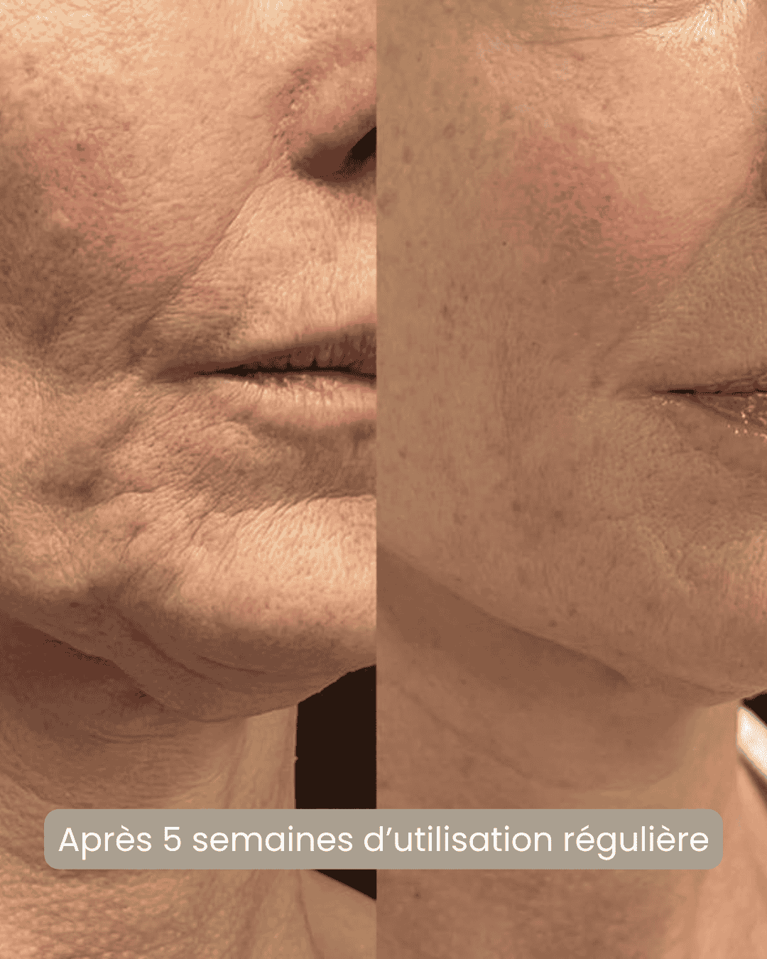 Masque LED visage Soin anti-âge